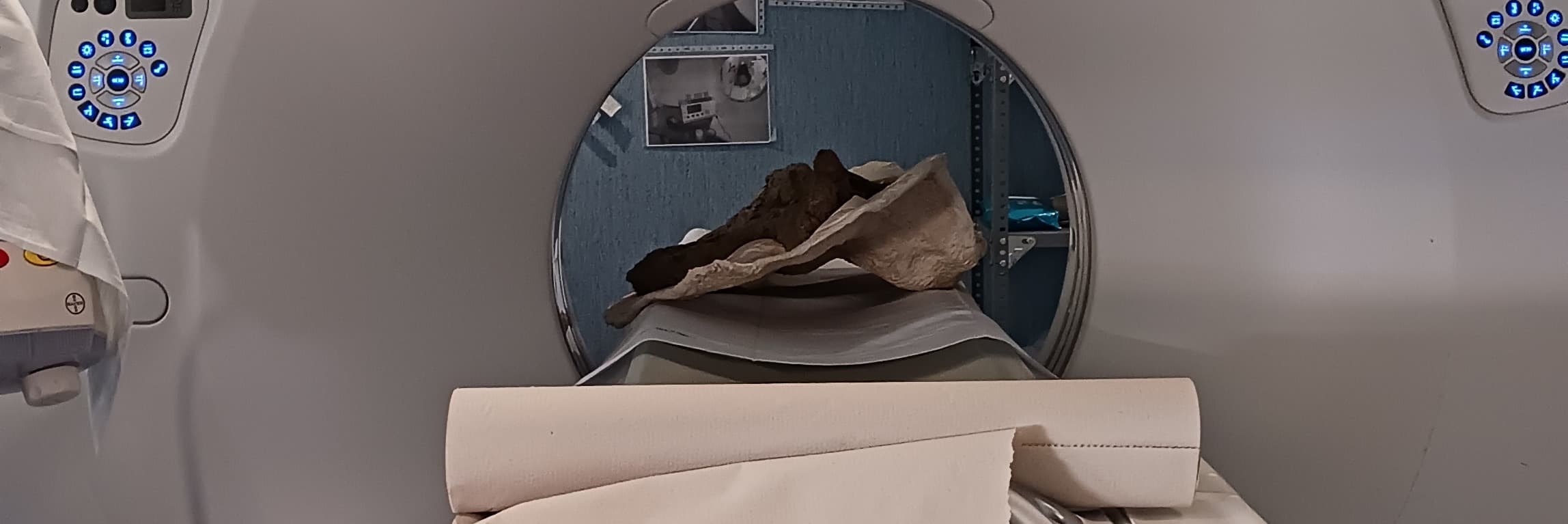 L'Hospital del Pallars fa un TAC a una vèrtebra d'un dinosaure de fa 70 milions d'anys